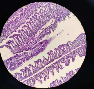 Laminillas branquiales con edema